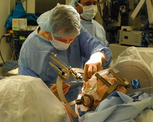 Ασθενής με νόσο Πάρκινσον θα υποβληθεί σε θεραπεία με εν τω βάθει εγκεφαλική διέγερση